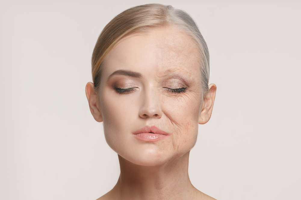 Split-face aging illustration showing how facial bone loss changes facial structure and contributes to visible aging.