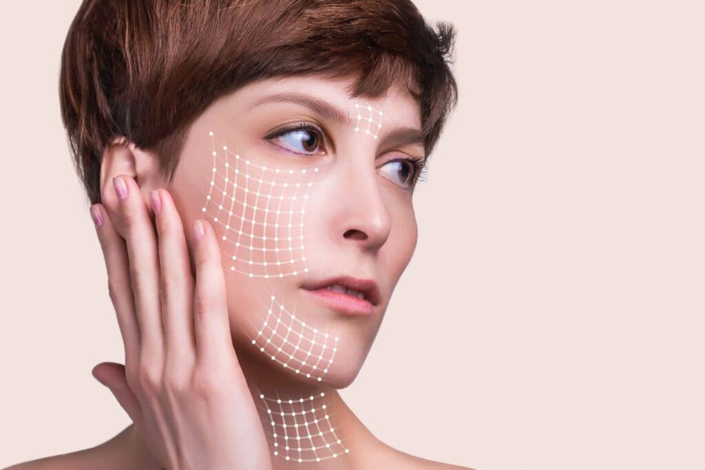 Facial anatomy overlay showing deep plane facelift treatment areas for structural rejuvenation.