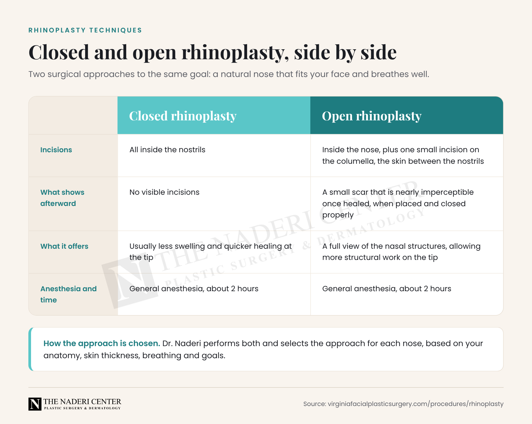 Comparison of closed and open rhinoplasty: incision location, what shows afterward, what each approach offers and anesthesia time