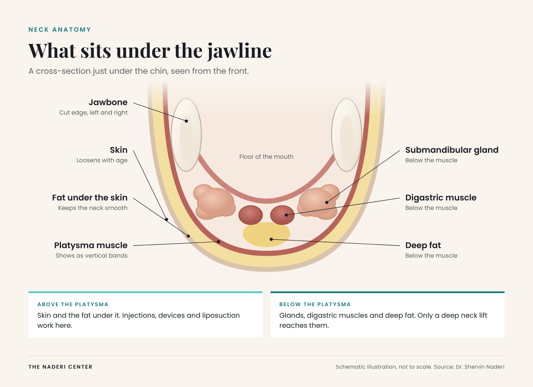 Anatomical cross-section just under the chin showing skin, fat under the skin, the platysma muscle and, below it, the submandibular glands, digastric muscles and deep fat