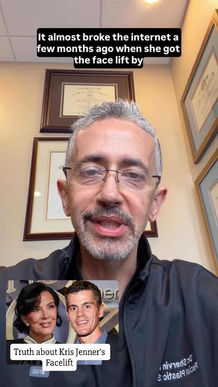 Dr. Shervin Naderi video: What Does Kris Jenner's Facelift Teach Us About How Long Results Last?