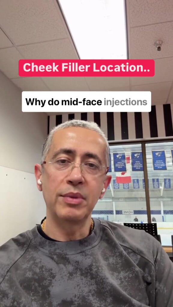 Video: Why Does Mid-Face Filler Make You Look Younger?