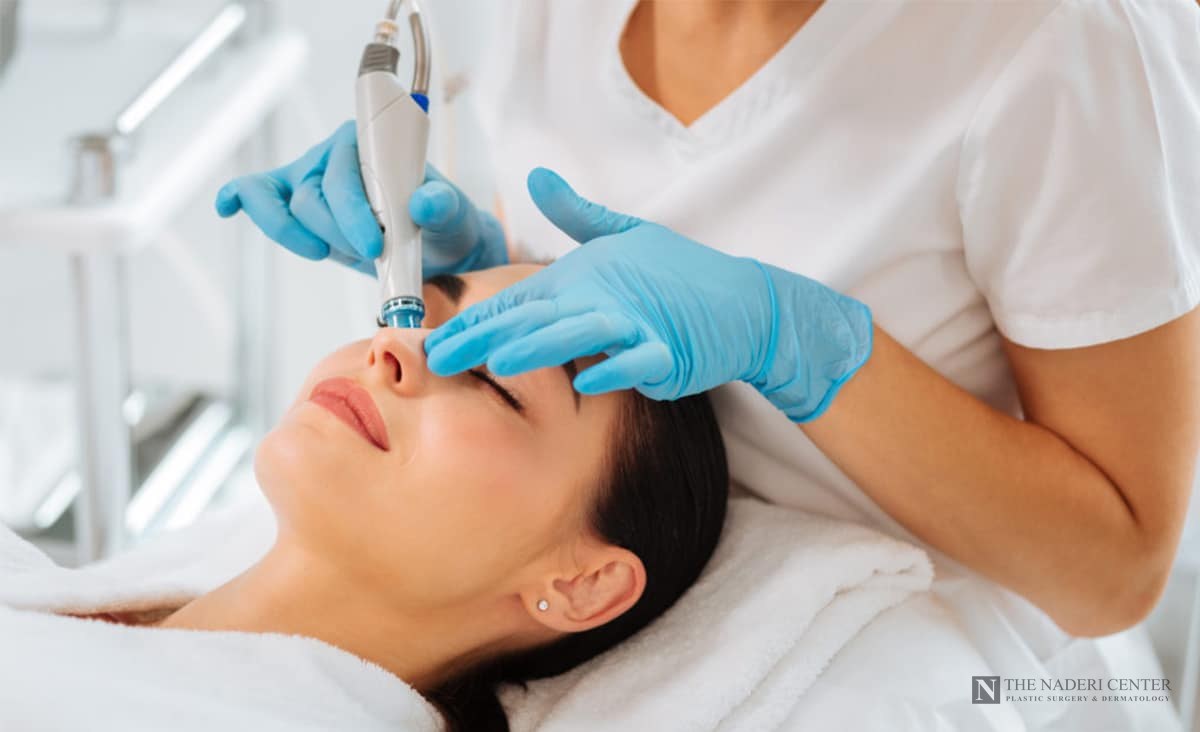 A HydraFacial treatment in progress, with the handheld device gently cleansing the skin, at The Naderi Center in Reston