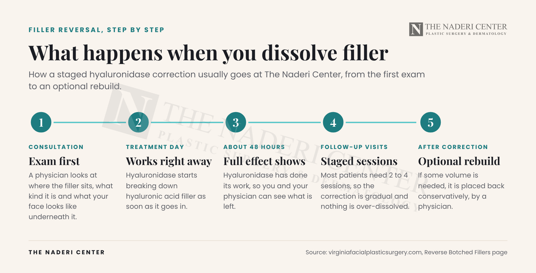 Timeline of dissolving filler with hyaluronidase at The Naderi Center: exam, treatment that works right away, full effect at about 48 hours, 2 to 4 staged sessions, optional rebuild