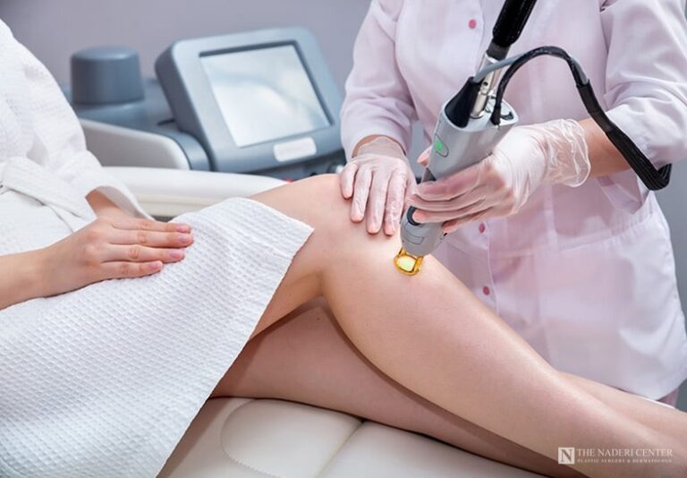 Laser hair removal treatment on the leg with a handheld laser at The Naderi Center in Reston, Virginia