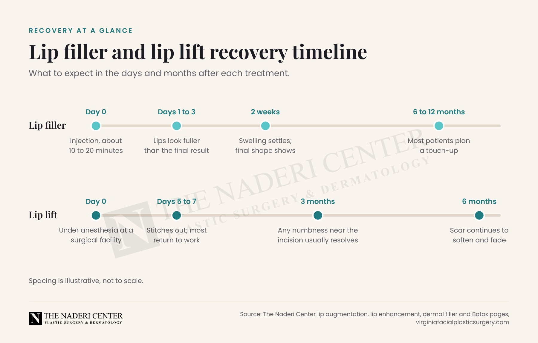 Timeline comparing lip filler recovery over two weeks with lip lift recovery, from stitch removal around day 5 to a softened scar at 6 months