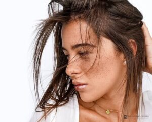 Woman with freckles and sun-darkened spots on her cheek, the kind of pigment treated at The Naderi Center in Reston and Chevy Chase