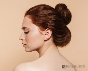 Side profile of a woman with a natural-looking nose