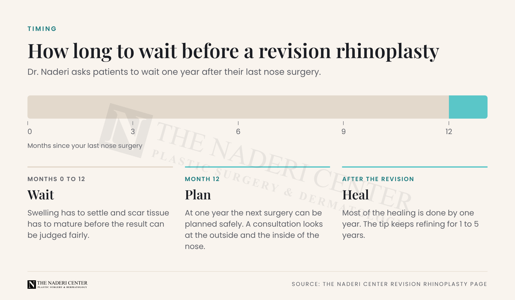 Timeline showing the one-year wait Dr. Naderi asks for between a patient's last nose surgery and a revision rhinoplasty.