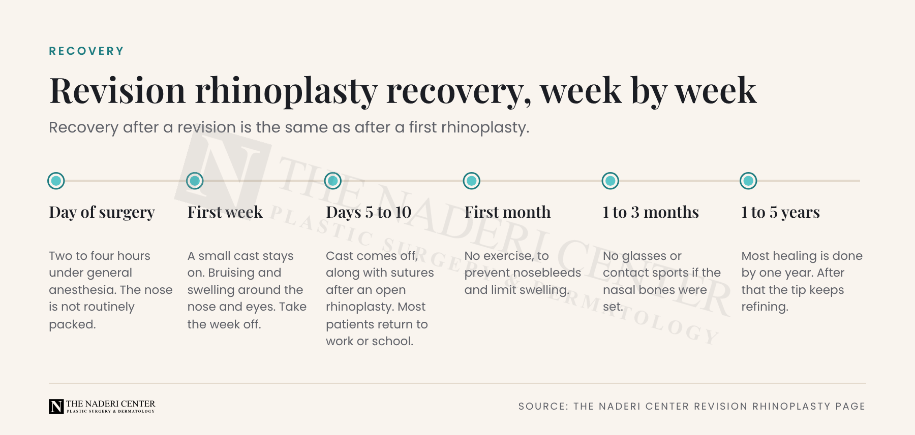 Revision rhinoplasty recovery timeline from the day of surgery through the first week, cast removal at days 5 to 10, the first month and 1 to 5 years.