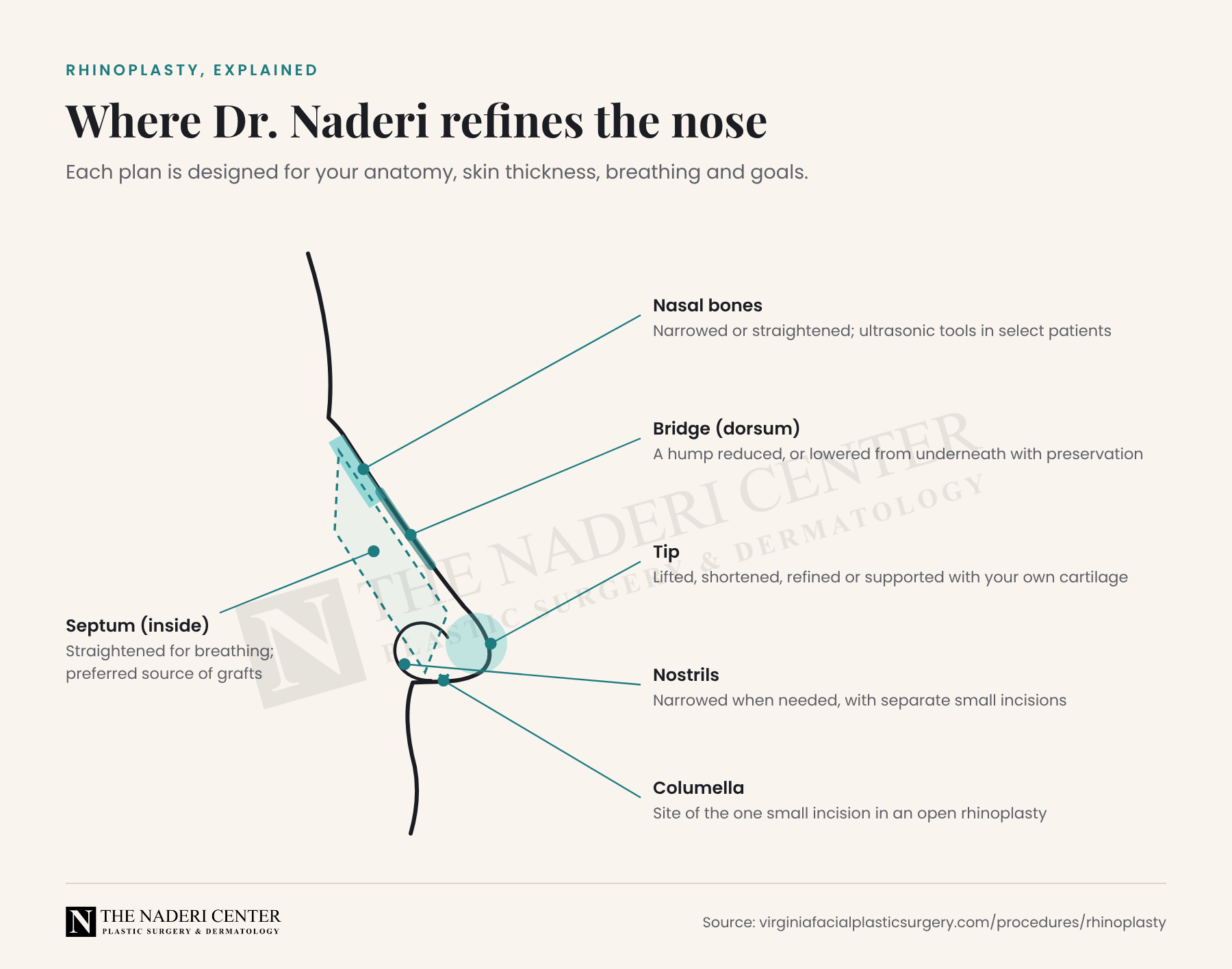Diagram of a nose in profile showing where Dr. Naderi refines the nasal bones, bridge, tip, nostrils, columella and septum during rhinoplasty