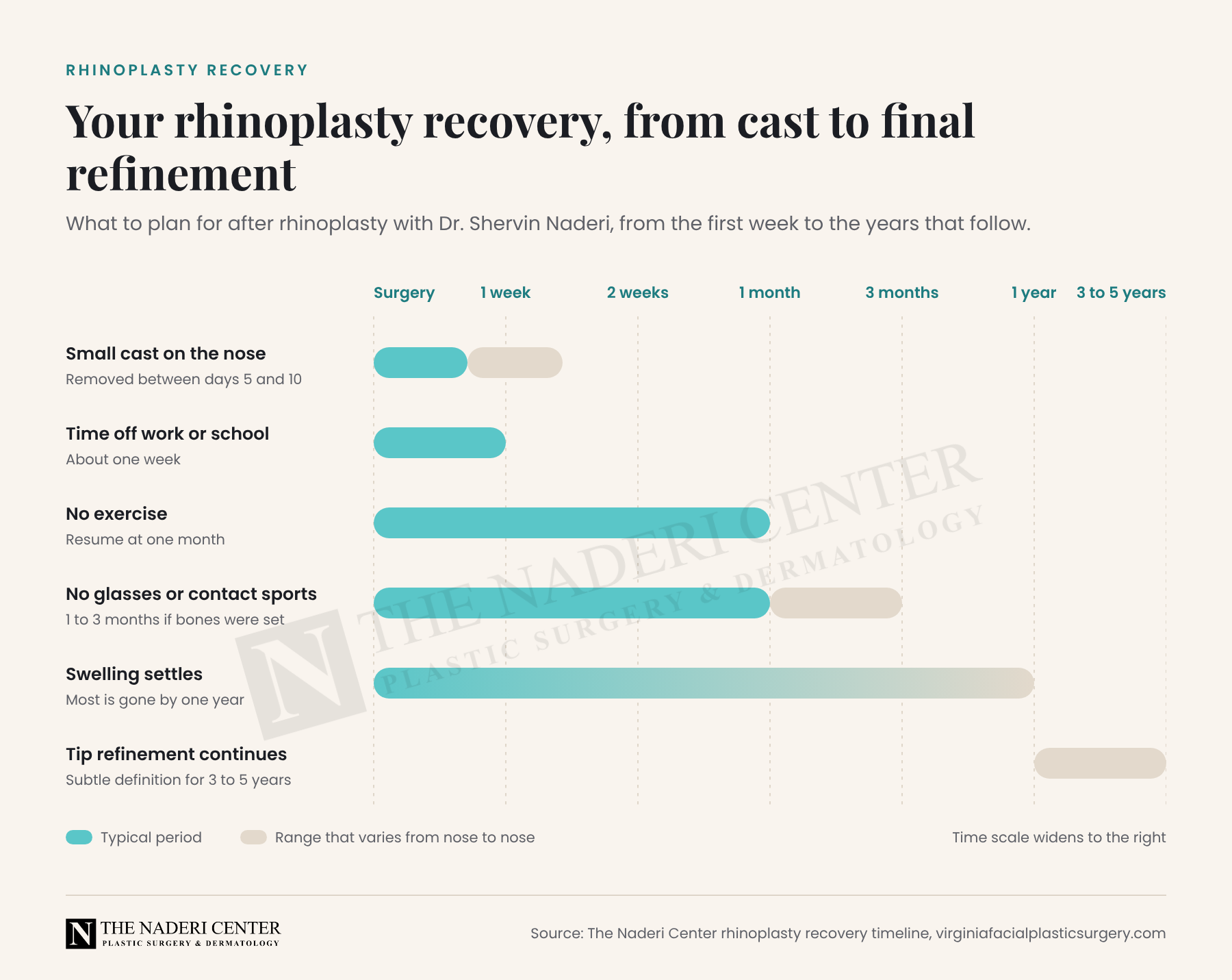Rhinoplasty recovery timeline from surgery through cast removal, return to work, exercise at one month, swelling settling by one year and tip refinement over three to five years