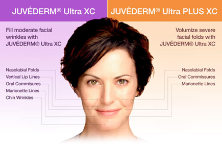 JUVEDERM Ultra XC vs JUVEDERM Ultra PLUS XC