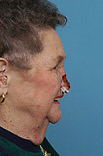 Herndon and Chevy Chase facial trauma, washington dc Herndon and Chevy Chase facial trauma, washington dc
